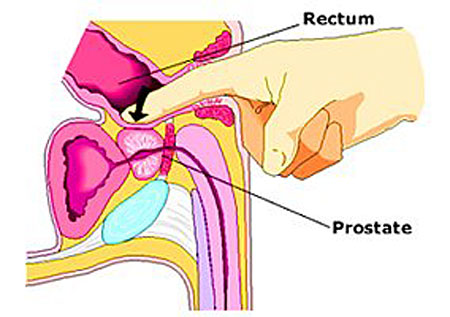 prostate massage for greater prostate health